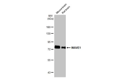Anti-WAVE1 antibody used in Western Blot (WB). GTX133263