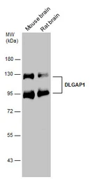 Anti-DLGAP1 antibody used in Western Blot (WB). GTX133264