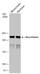 Anti-Neurofascin antibody used in Western Blot (WB). GTX133266
