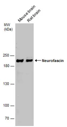 Anti-Neurofascin antibody used in Western Blot (WB). GTX133274