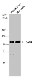 Anti-CASK antibody used in Western Blot (WB). GTX133275