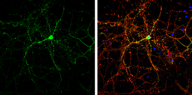 Anti-CASK antibody used in Immunocytochemistry/ Immunofluorescence (ICC/IF). GTX133275