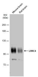 Anti-LRRC4 antibody used in Western Blot (WB). GTX133276