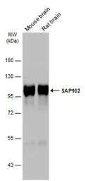 Anti-SAP102 antibody used in Western Blot (WB). GTX133279