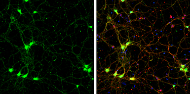 Anti-SAP102 antibody used in Immunocytochemistry/ Immunofluorescence (ICC/IF). GTX133279