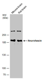 Anti-Neurofascin antibody used in Western Blot (WB). GTX133281