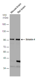 Anti-Striatin 4 antibody used in Western Blot (WB). GTX133282