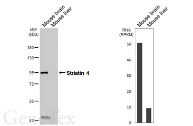 Anti-Striatin 4 antibody used in Western Blot (WB). GTX133282