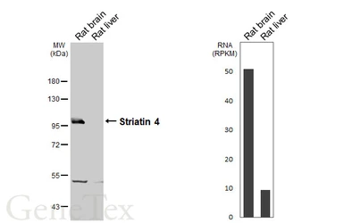 Anti-Striatin 4 antibody used in Western Blot (WB). GTX133282
