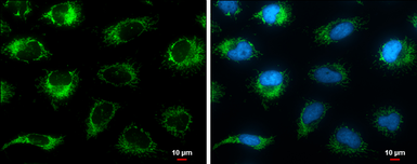 Anti-Grp75 antibody used in Immunocytochemistry/ Immunofluorescence (ICC/IF). GTX133283