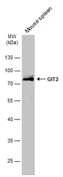 Anti-GIT2 antibody used in Western Blot (WB). GTX133285