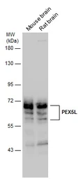 Anti-PEX5L antibody used in Western Blot (WB). GTX133287