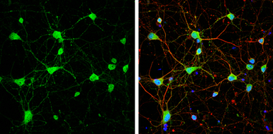 Anti-mGluR5 antibody used in Immunocytochemistry/ Immunofluorescence (ICC/IF). GTX133288