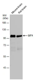 Anti-GIT1 antibody used in Western Blot (WB). GTX133292