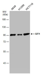 Anti-GIT1 antibody used in Western Blot (WB). GTX133292