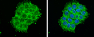 Anti-GIT1 antibody used in Immunocytochemistry/ Immunofluorescence (ICC/IF). GTX133292