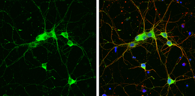 Anti-GIT1 antibody used in Immunocytochemistry/ Immunofluorescence (ICC/IF). GTX133292