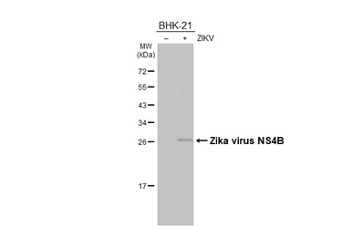 Anti-Zika virus NS4B protein antibody used in Western Blot (WB). GTX133311