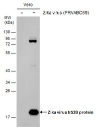 Anti-Zika virus NS2B protein antibody used in Western Blot (WB). GTX133318