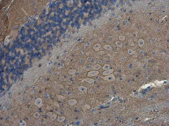 Anti-SH3GL1 antibody used in IHC (Paraffin sections) (IHC-P). GTX133333