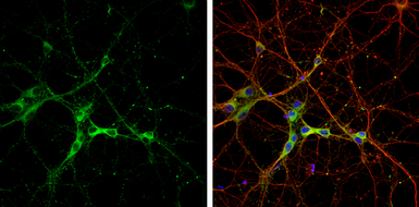Anti-SH3GL1 antibody used in Immunocytochemistry/ Immunofluorescence (ICC/IF). GTX133333