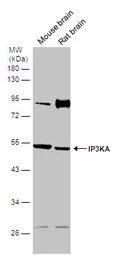 Anti-IP3KA antibody used in Western Blot (WB). GTX133334