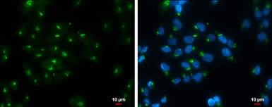 Anti-Rap1GAP antibody used in Immunocytochemistry/ Immunofluorescence (ICC/IF). GTX133335