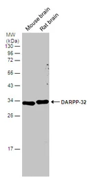 Anti-DARPP-32 antibody used in Western Blot (WB). GTX133336