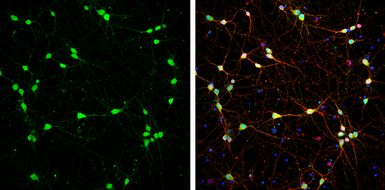 Anti-DARPP-32 antibody used in Immunocytochemistry/ Immunofluorescence (ICC/IF). GTX133336