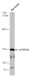 Anti-p130Cas antibody used in Western Blot (WB). GTX133337