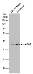 Anti-ABAT antibody used in Western Blot (WB). GTX133340