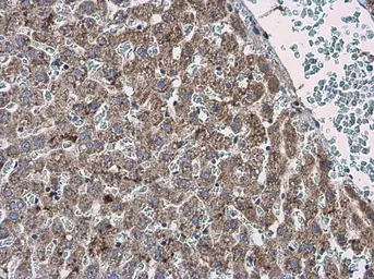 Anti-ABAT antibody used in IHC (Paraffin sections) (IHC-P). GTX133340