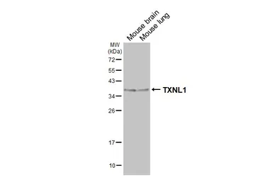 Anti-TXNL1 antibody used in Western Blot (WB). GTX133341