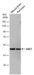 Anti-ABAT antibody used in Western Blot (WB). GTX133344