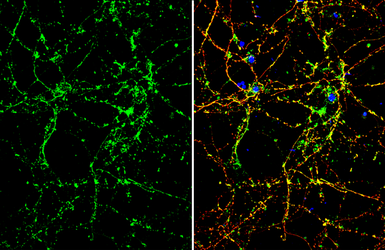Anti-OTUB1 antibody used in Immunocytochemistry/ Immunofluorescence (ICC/IF). GTX133347