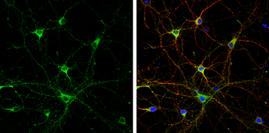 Anti-SH3GL1 antibody used in Immunocytochemistry/ Immunofluorescence (ICC/IF). GTX133349