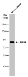 Anti-MFN1 antibody used in Western Blot (WB). GTX133351