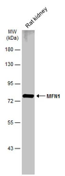 Anti-MFN1 antibody used in Western Blot (WB). GTX133351