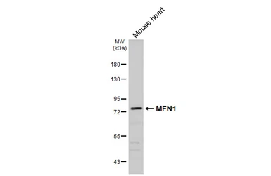 Anti-MFN1 antibody used in Western Blot (WB). GTX133351