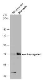Anti-Neuregulin-1 antibody used in Western Blot (WB). GTX133355