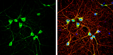 Anti-Neuregulin-1 antibody used in Immunocytochemistry/ Immunofluorescence (ICC/IF). GTX133355