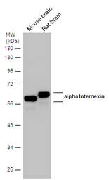 Anti-alpha Internexin antibody used in Western Blot (WB). GTX133356