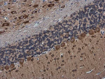 Anti-Rap1GAP antibody used in IHC (Paraffin sections) (IHC-P). GTX133357