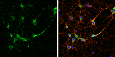Anti-Rap1GAP antibody used in Immunocytochemistry/ Immunofluorescence (ICC/IF). GTX133357