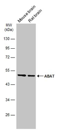Anti-ABAT antibody used in Western Blot (WB). GTX133362