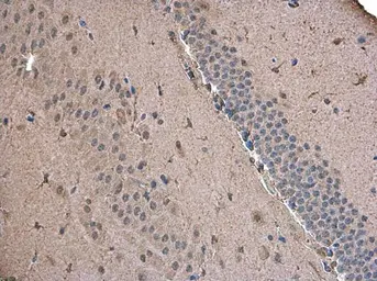 Anti-ABAT antibody used in IHC (Paraffin sections) (IHC-P). GTX133362