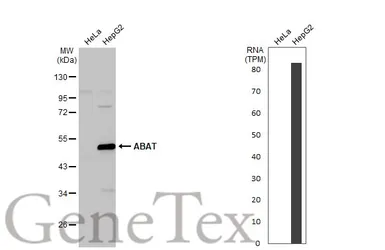 Anti-ABAT antibody used in Western Blot (WB). GTX133362