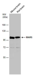 Anti-MARS antibody used in Western Blot (WB). GTX133363