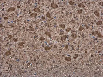 Anti-MARS antibody used in IHC (Paraffin sections) (IHC-P). GTX133363