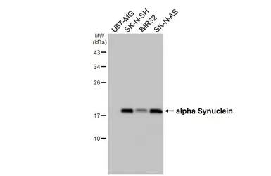 Anti-alpha Synuclein antibody used in Western Blot (WB). GTX133367